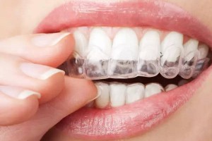 假牙用超声波清洗效果怎么样？对假牙有害吗?